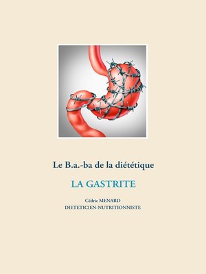 cover image of Le B.a.-ba diététique de la gastrite